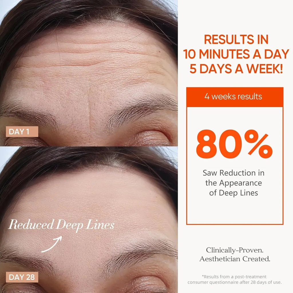 LED Phototherapy Face Mask